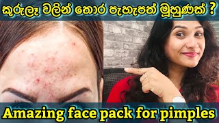 How to get rid of Acne | most effective neem face pack for acne | pimples | at home | DIY | sinhala