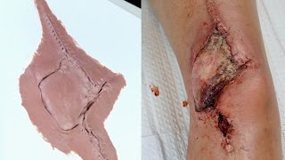 Sculpting the Infected Knee Tutorial | Freakmo and Powdah Collab