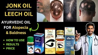 LEECH OIL | JONK OIL | FOR ALOPECIA | JONK KA TEL | HOW TO USE | REVIEW \u0026 RESULTS | ESSENTIAL OIL