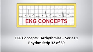 EKG Concepts: Arrhythmias Course - Strip 32 of 39