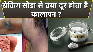 Baking Soda से क्या सच में दूर होता है कालापन । बेकिंग सोडा से कालापन दूर करने के उपाय। Boldsky