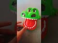 Crocodile Dentist Game Gigit Buaya