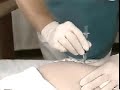 Medical Procedures: Z track method of Intramuscular Injection