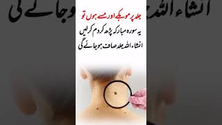 Mohkay khatm Karne ka Wazifa | Wazifa to remove moles | Wazifa for fair skin | #shorts #wazifa