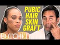 Dog Attack Survivor Left with Pubic Hair Growing on Her Face FULL TRANSFORMATION | Botched | E!