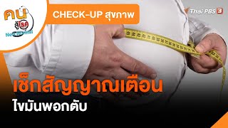 เช็กสัญญาณเตือนไขมันพอกตับ : CHECK-UP สุขภาพ