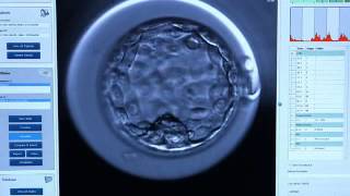 Create Health EmbryoScope time-lapse system