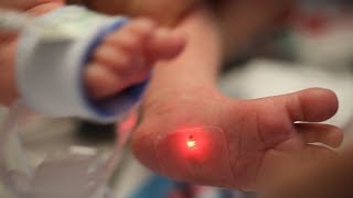 Sensors are first to monitor babies in the NICU