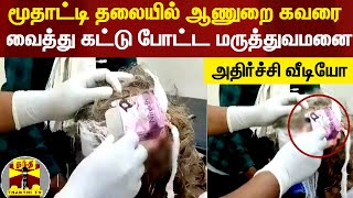 மூதாட்டி தலையில் ஆணுறை கவரை வைத்து கட்டு போட்ட மருத்துவமனை - மத்திய பிரதேசத்தில் அதிர்ச்சி