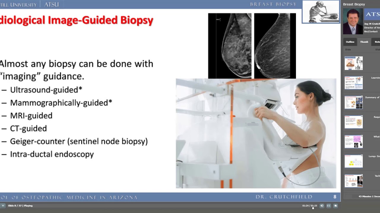 Breast Biopsy - YouTube