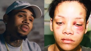 Chris Brown Details Rihanna Assault: She Tried To Kick Me, I Bit Her Arm