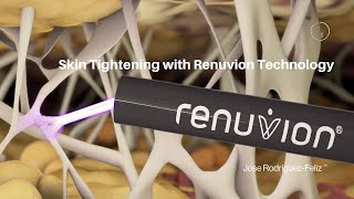 Skin Tightening with Renuvion Technology