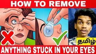 4 Easy Ways To Remove Something From Eyes | how to remove dust from eyes | கண்களில் தூசி | In Tamil