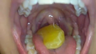Girl swallowing gummys vore