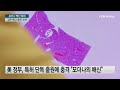 모더나 백신 특허 단독 출원 논란...