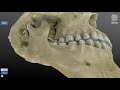 skull anatomy أسهل طريقة لفهم تشريح الجمجمة part 2 2