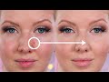 How to Cover and Conceal Acne Blemishes | Makeup Tutorial