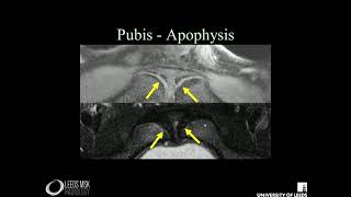 Imaging of the pelvis