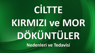 CİLTTE KIRMIZI VE MOR DÖKÜNTÜLER NEDEN OLUR?