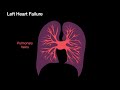 acute consolidation chest radiology essentials