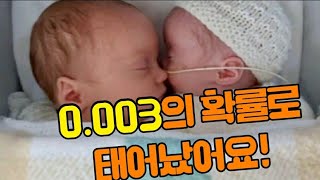 #월드뉴스#중복임신 함께태어났지만 쌍둥이는 아니에요