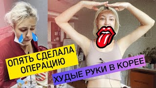 Я СДЕЛАЛА ЛИПОСАКЦИЮ! ПЛАСТИКА В КОРЕЕ🧡MY LIPO EXPERIENCE IN KOREA