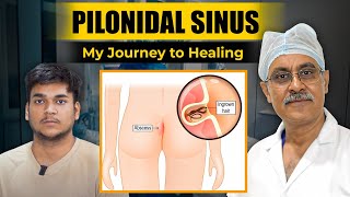 Pilonidal Sinus | Pilonidal Cyst Treatment and Causes | Best Hospital for Pilonidal Sinus | Apollo