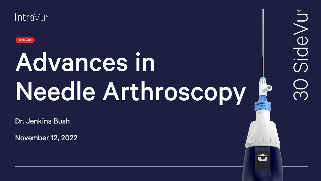 Advances In Needle Arthroscopy | 30 SideVu Webinar - YouTube