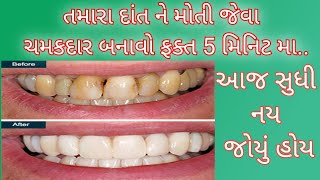 પીળા દાંતને સફેદ કરવાની એક અનોખી રીત જે પહેલા ક્યારેય નય જોઈ હોય | dat saf karva mate gharelu upay