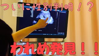 【Baby's gender】赤ちゃんの性別が分かる瞬間 【ultrasound】