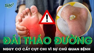 Biến chứng bàn chân tiểu đường: nguy cơ cắt cụt chi nếu chủ quan | SKĐS