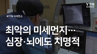 최악의 미세먼지...심장·뇌에도 치명적 / YTN 사이언스