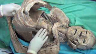 Chest Part 2: Anatomy Dissection and Description of Thoracic cavity: Amazing Human Body