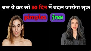 ACNE FREE| pimples se chhutkara|  चेहरे के दाने (मुहांसा)|