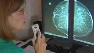 Diagnostic Mammography