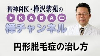 円形脱毛症の治し方【精神科医・樺沢紫苑】