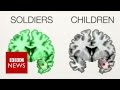 The PTSD brains of children & soldiers - BBC News