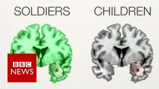 The PTSD brains of children & soldiers - BBC News