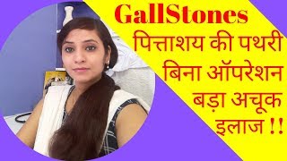 Gallstones symptoms \u0026 homeopathic treatment | gallbladder stones symptoms \u0026 homeopathic medicine