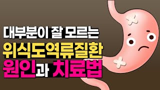 신물이 올라오고 가슴이 쓰리다면 무조건 역류성 식도염? 대부분이 헷갈려하는 위식도역류질환 원인과 치료법