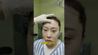 起来有点懵B #facelifts #beauty #makeupartist #thread #faceliftspecialist #makeup #skincare