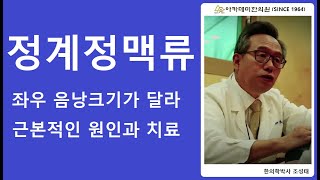 정계정맥류. 근본적인 원인과 치료.