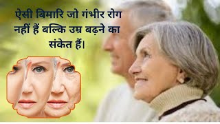 6 बीमारियां जो रोग नहीं, उम्र बढ़ने के संकेत हैं | 6 Aging Signs | #signsofaging #agingprevention