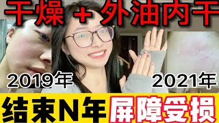 （干+屏障受损+外油内干）多年经验总结