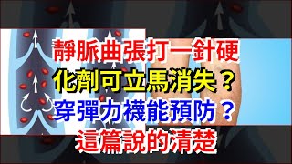 靜脈曲張打一針硬化劑可立馬消失？穿彈力襪能預防？這篇說的清楚