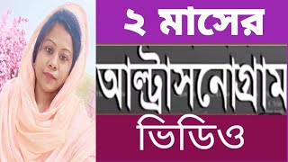 ২ মাসের আল্ট্রাসনোগ্রাম লাইভ ভিডিও দেখে নিন