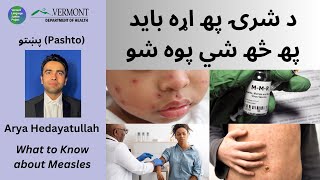 Pashto: د شرۍ پھ اړه باید پھ څھ شي پوه شو | What to Know About Measles