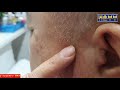 💥💈바리깡커트 남자커트 쉽게 자르는법 how to easily cut a barrican cut male cut