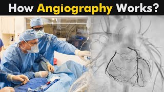 What is Angiography? | How Coronary Angiography works? (Urdu/Hindi)