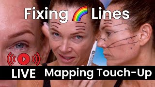 Fixing Rainbow Lines Above Eyebrows | Dehantox 100 Unit Face Mapping (Live Replay)